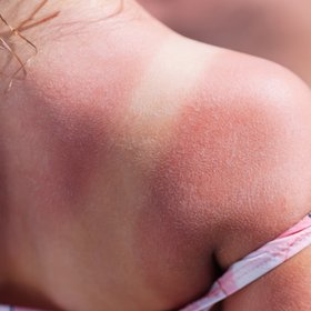 В тиктоке новый тренд: неровный загар, который зумеры создают специально