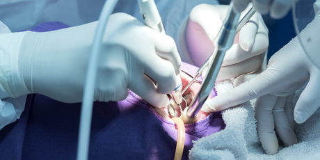 Более половины россиян боятся стоматологов