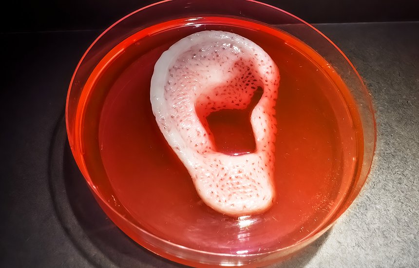 Ухо, созданное из собственных клеток пациента с помощью 3D-биопринтера Институтом регенеративной медицины Уэйк-Форест, США