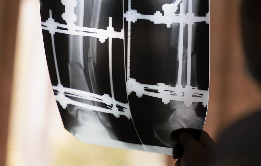 Операция по увеличению роста