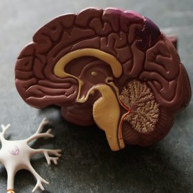 Исследование: недосып уменьшает объем мозга