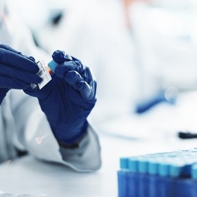 Синдром Каллмана у Гитлера: что обнаружили генетики в новом анализе ДНК