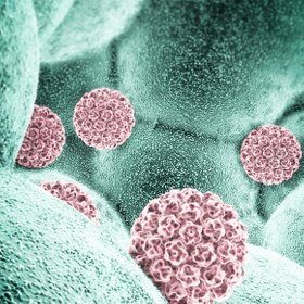 Анализ на ВПЧ стал бесплатным для россиянок по ОМС: зачем он нужен, что выявляет и где его сдать