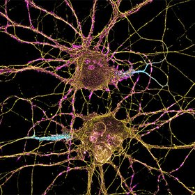 Курс дня: бесплатные лекции по нейронауке от Гарвардского профессора