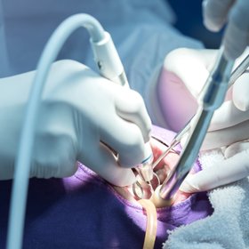 Более половины россиян боятся стоматологов