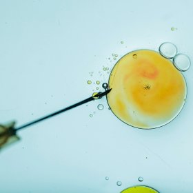 «Говорят, что мы играем в Бога, но это не так»: молодая эмбриолог — об искусственном оплодотворении людей и рыб