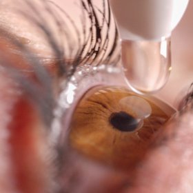 В США одобрили первые глазные капли, которые возвращают зрение вблизи