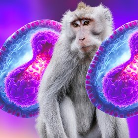 Оспа обезьян: что это за болезнь, чем опасна и кто в группе риска